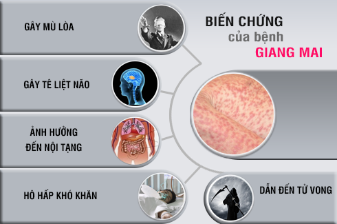 Biến chứng của bệnh giang mai